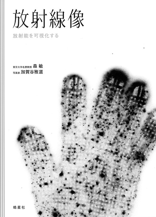 放射線像