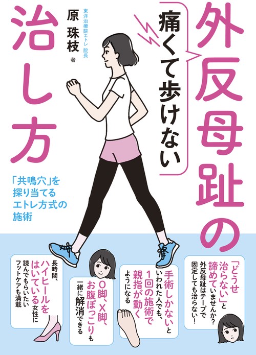 痛くて歩けない外反母趾の治し方