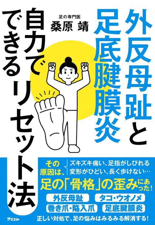 外反母趾と足底腱膜炎 自力でできるリセット法