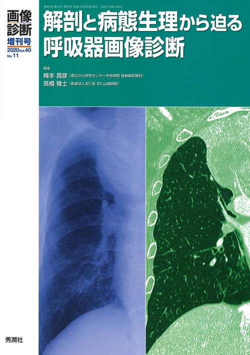 画像診断２０２０年増刊号（Ｖｏｌ．４０　Ｎｏ．１１）