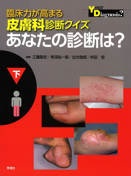 臨床力が高まる皮膚科診断クイズ　下