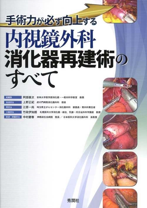 内視鏡外科消化器再建術のすべて