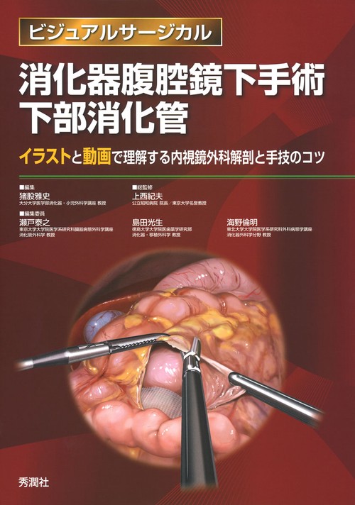 消化器腹腔鏡下手術　下部消化管