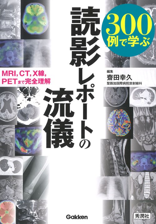 ３００例で学ぶ　読影レポートの流儀
