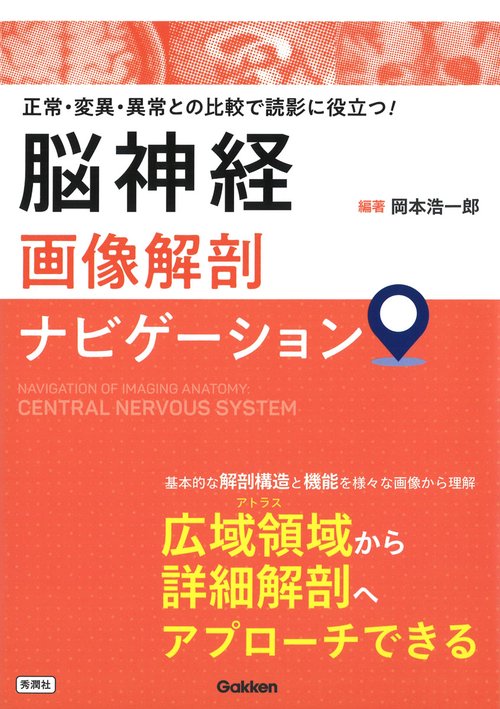 脳神経画像解剖ナビゲーション