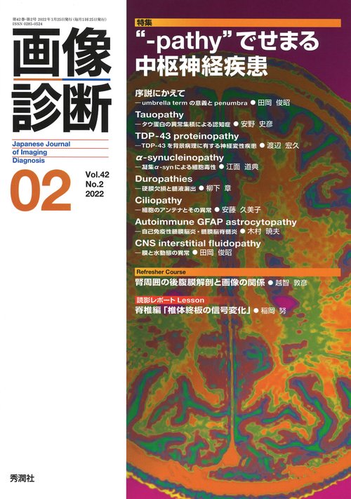画像診断２０２２年２月号　Ｖｏｌ．４２　Ｎｏ．２