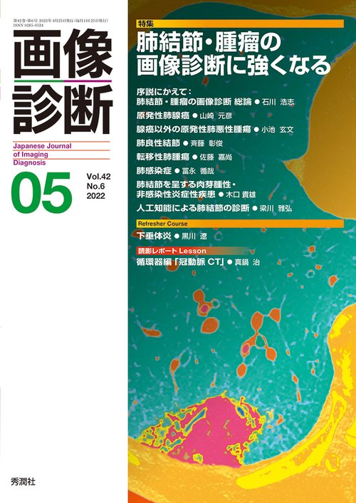 画像診断２０２２年５月号　Ｖｏｌ．４２　Ｎｏ．６