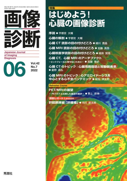 画像診断２０２２年６月号　Ｖｏｌ．４２　Ｎｏ．７