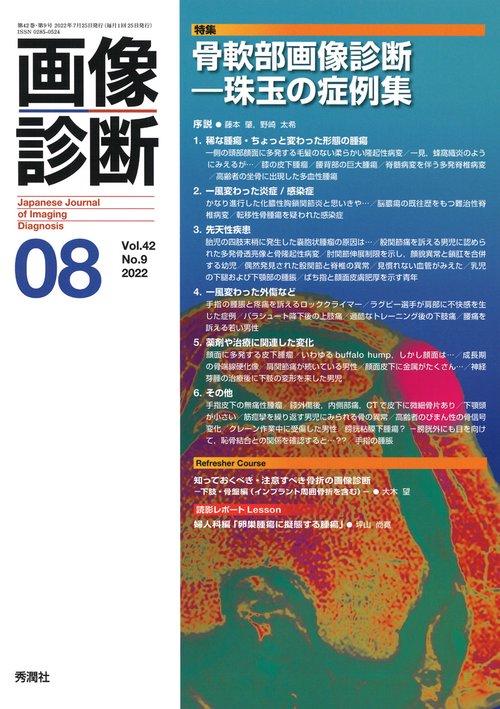 画像診断２０２２年８月号　Ｖｏｌ．４２　Ｎｏ．９