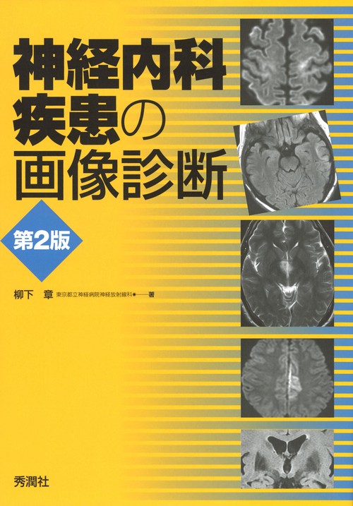 神経内科疾患の画像診断　第２版