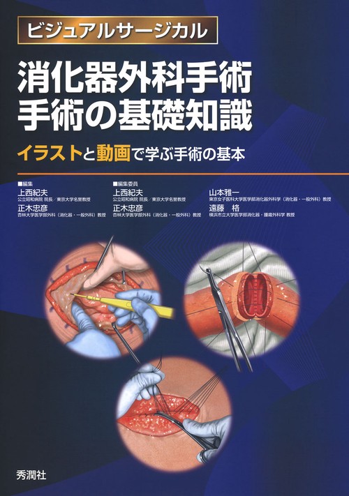 消化器外科手術　手術の基礎知識