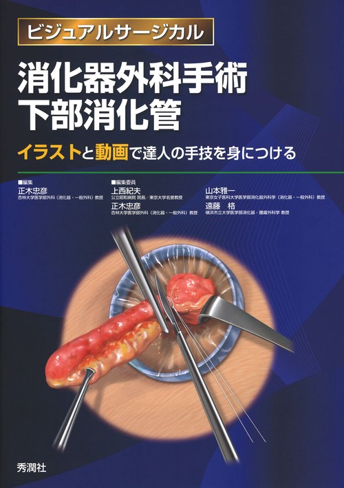 消化器外科手術　下部消化管