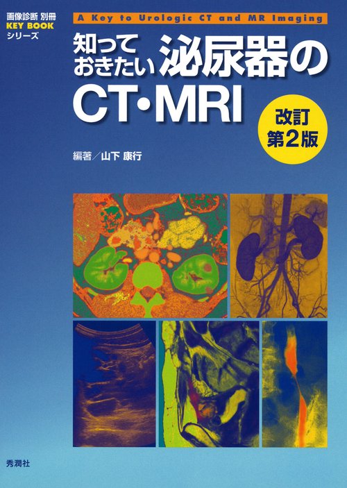 知っておきたい泌尿器のＣＴ・ＭＲＩ　改訂第２版