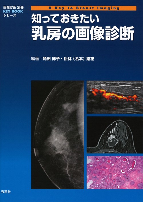知っておきたい乳房の画像診断