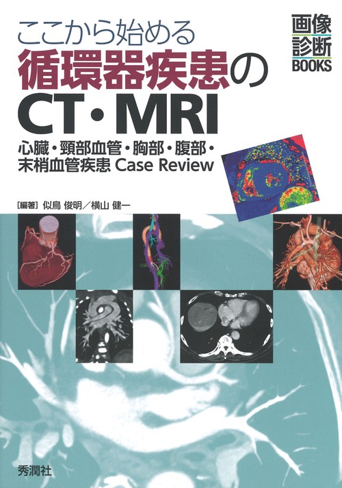 ここから始める循環器疾患のＣＴ・ＭＲＩ
