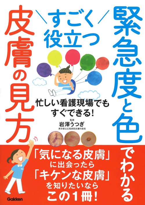 すごく役立つ　緊急度と色でわかる皮膚の見方