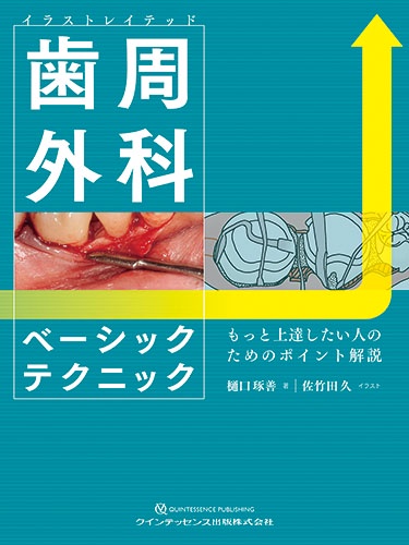 イラストレイテッド歯周外科ベーシックテクニック もっと上達したい人のためのポイント解説