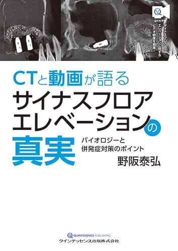 CTと動画が語るサイナスフロアエレベーションの真実 バイオロジーと併発症対策のポイント