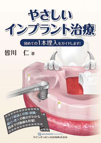 やさしいインプラント治療 初めての1本埋入をガイドします!