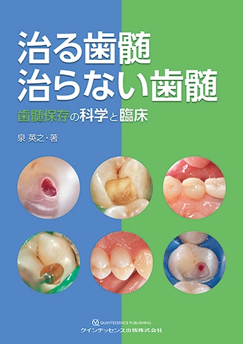 治る歯髄治らない歯髄 歯髄保存の科学と臨床