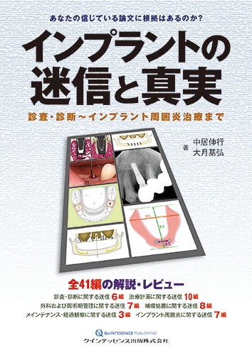 インプラントの迷信と真実 診査・診断〜インプラント周囲炎治療まで
