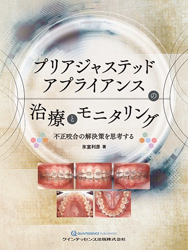 プリアジャステッドアプライアンスの治療とモニタリング 不正咬合の解決策を思考する