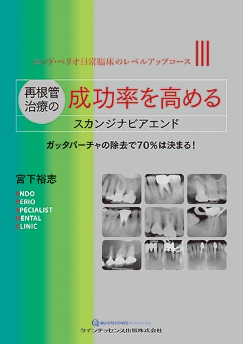 再根管治療の成功率を高めるスカンジナビアエンド ガッタパーチャの除去で70%は決まる!