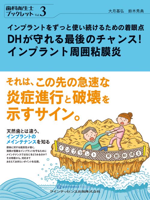 DHが守れる最後のチャンス！ インプラント周囲粘膜炎