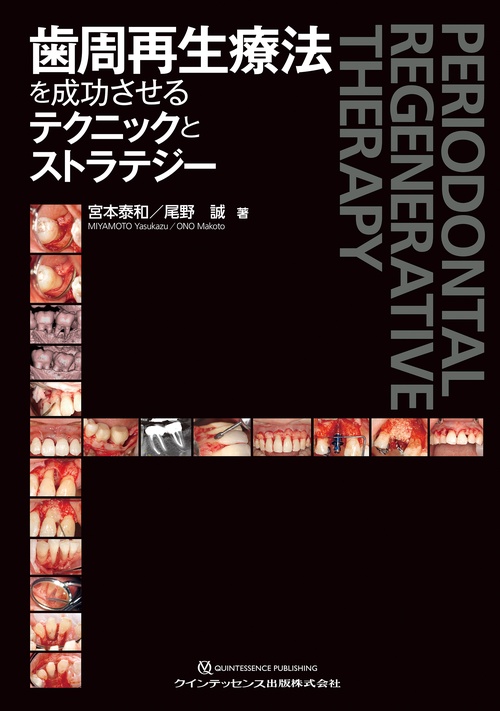 歯周再生療法を成功させるテクニックとストラテジー