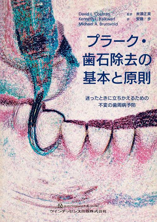 プラーク・歯石除去の基本と原則