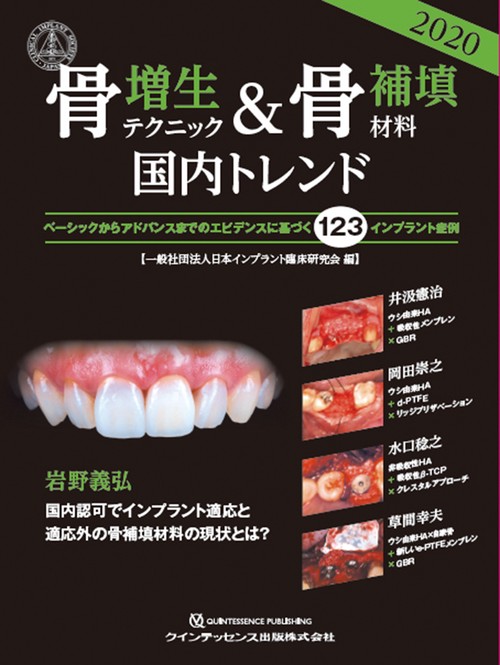 骨増生テクニック&骨補填材料2020国内トレンド