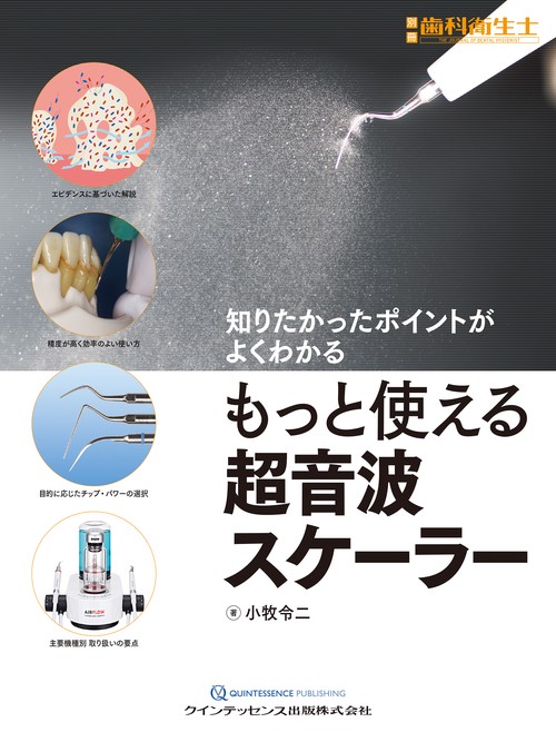 もっと使える超音波スケーラー