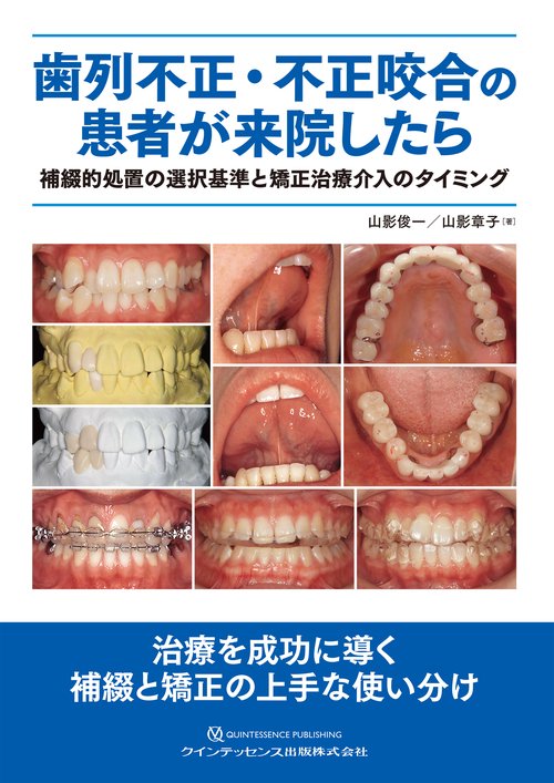 歯列不正・不正咬合の患者が来院したら