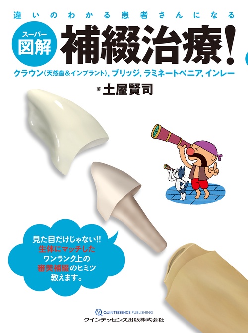 スーパー図解　補綴治療！