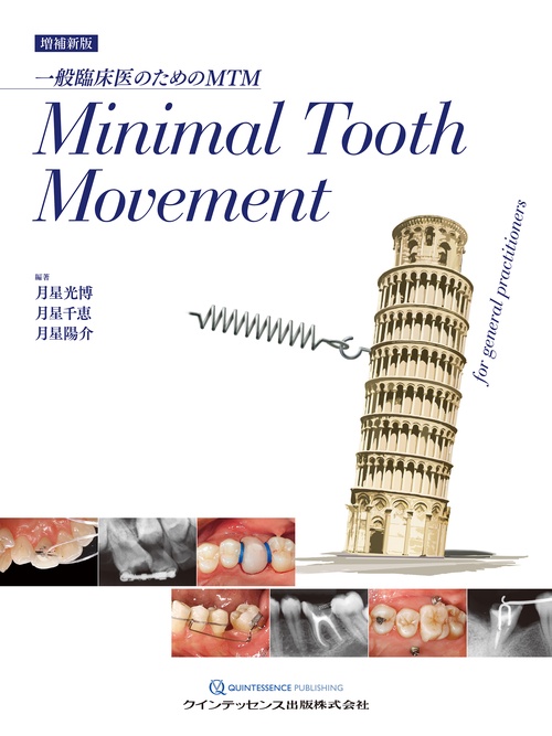増補新版　Minimal Tooth Movement