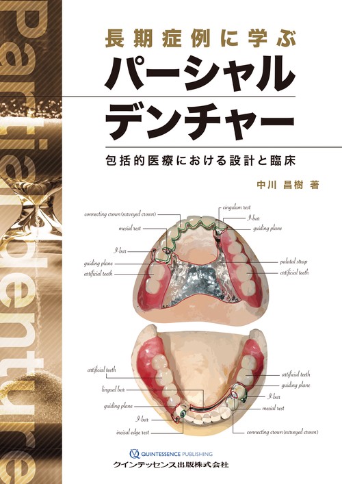 長期症例に学ぶパーシャルデンチャー