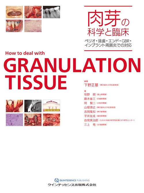 肉芽の科学と臨床