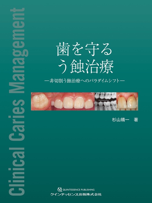 歯を守る　う蝕治療