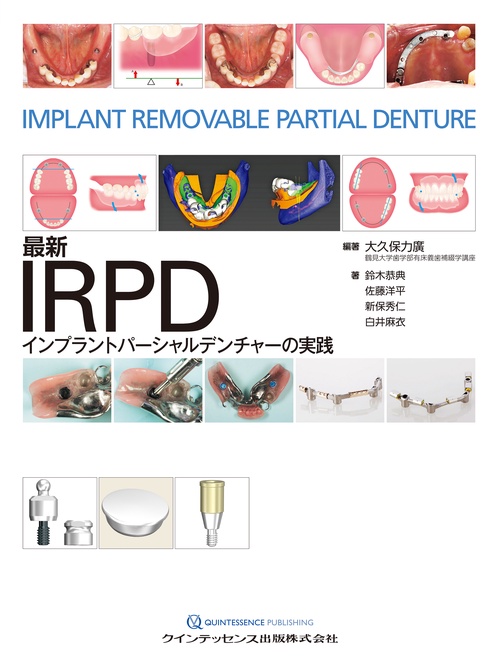 最新IRPD　 インプラントパーシャルデンチャーの実践