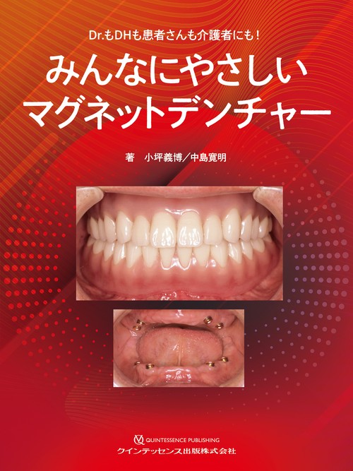 みんなにやさしいマグネットデンチャー