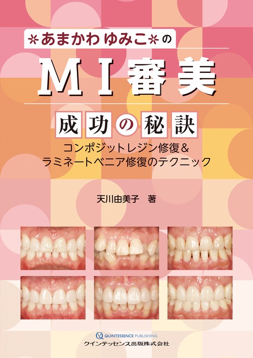 あまかわゆみこのMI審美 成功の秘訣