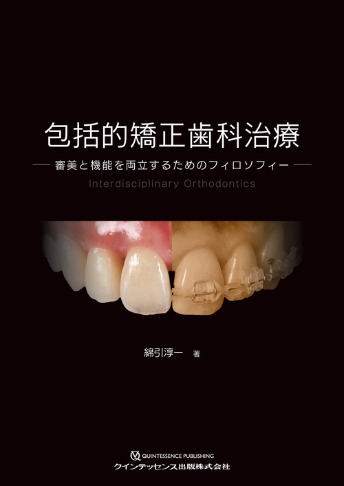 包括的矯正歯科治療