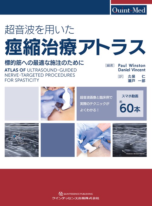 超音波を用いた痙縮治療アトラス