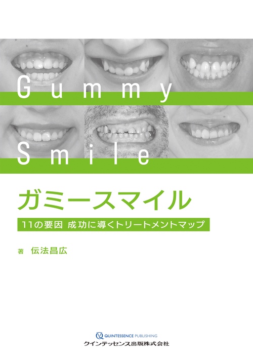 ガミースマイル