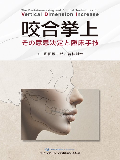 咬合挙上