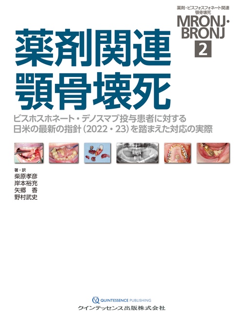 薬剤関連顎骨壊死