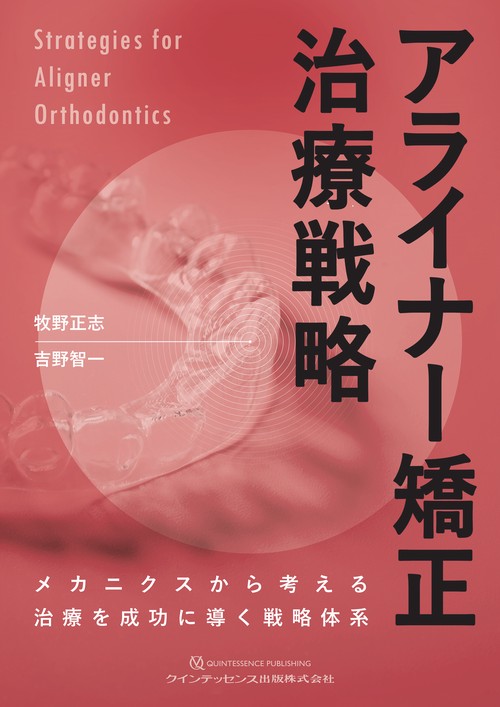 アライナー矯正治療戦略