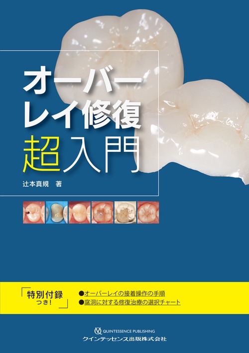 オーバーレイ修復　超入門