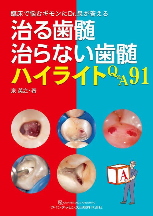 治る歯髄 治らない歯髄 ハイライトQ&A91