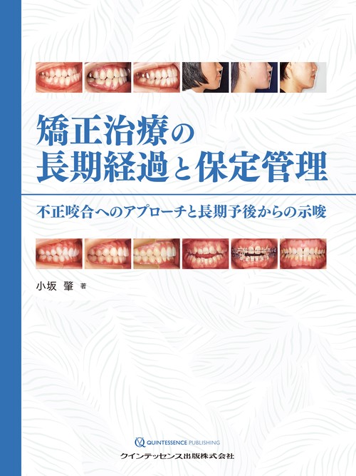 矯正治療の長期経過と保定管理